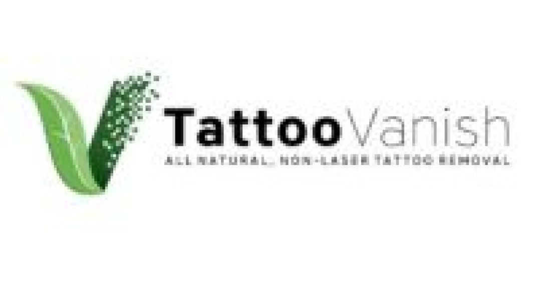 Tattoo Vanish